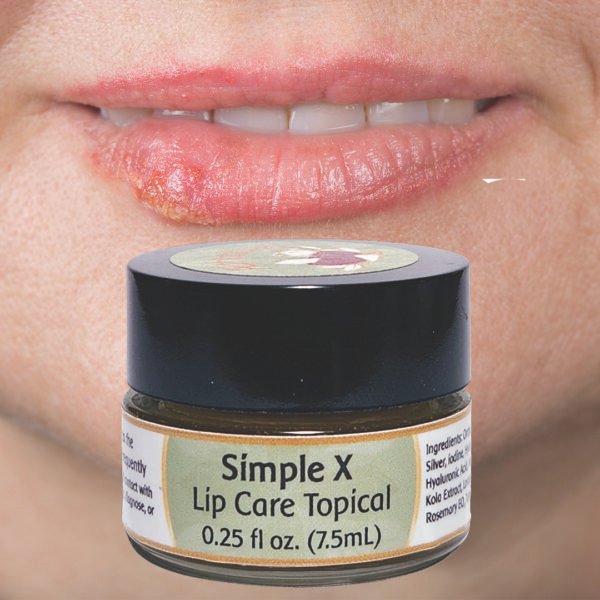 Simple X Lip Care - Image 6